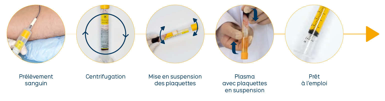 process fra ACP HA