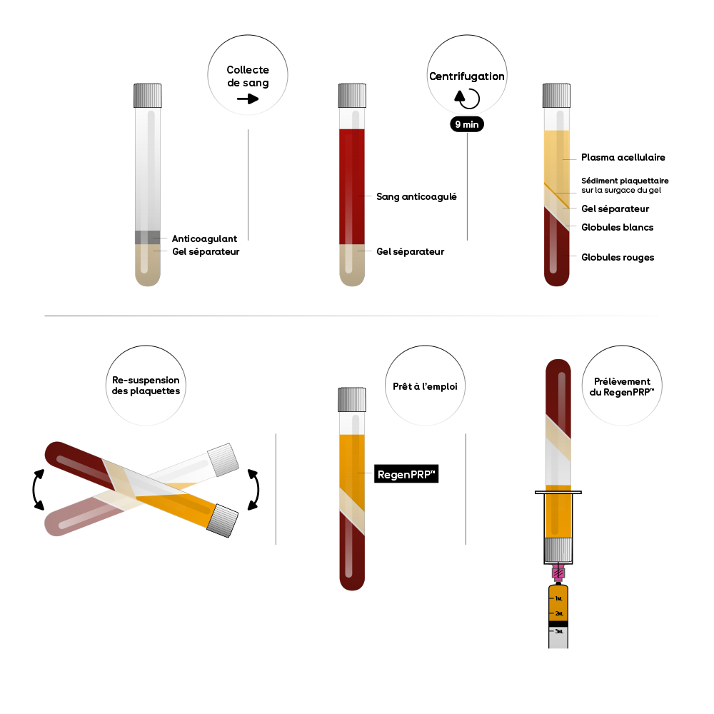 tube tht